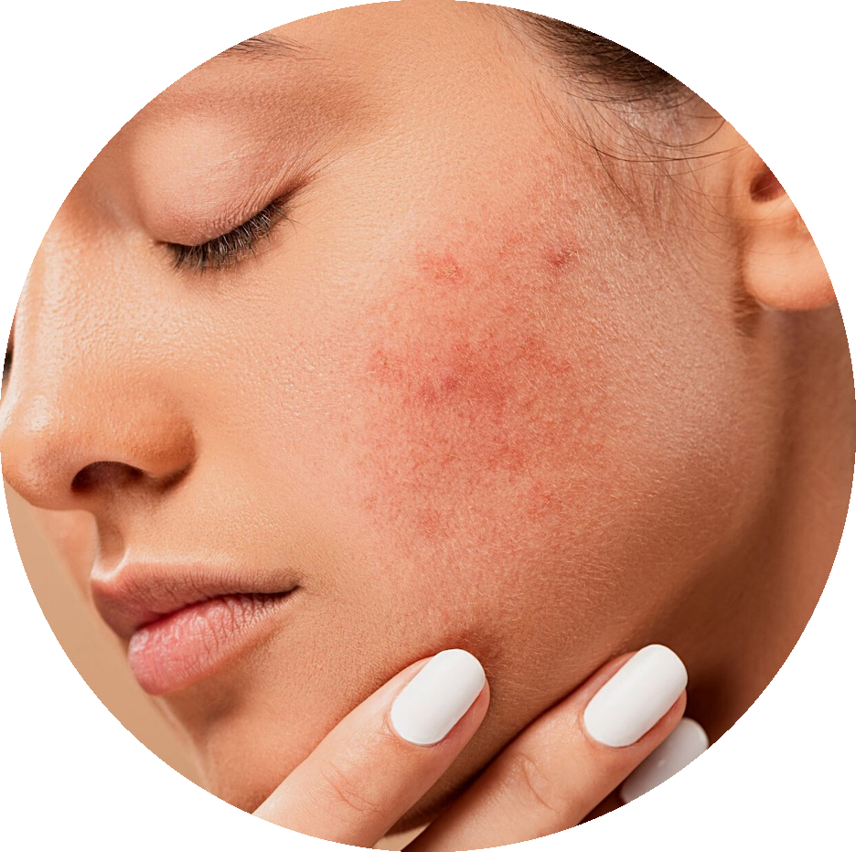 laitde chamelle dermatologie